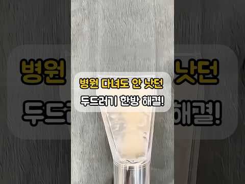 아이 피부 알레르기 두드러기 완화, 패브릭 소파 청소의 놀라운 변화